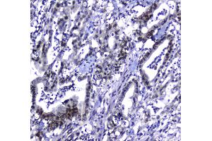 IHC analysis of MDC1 using anti-MDC1 antibody . (MDC1 抗体  (AA 534-626))