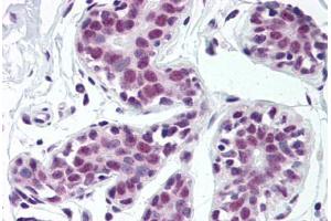 Human Breast (formalin-fixed, paraffin-embedded) stained with TARDBP antibody ABIN307182 at 5 ug/ml followed by biotinylated goat anti-rabbit IgG secondary antibody ABIN481713, alkaline phosphatase-streptavidin and chromogen. (TARDBP 抗体  (Internal Region))