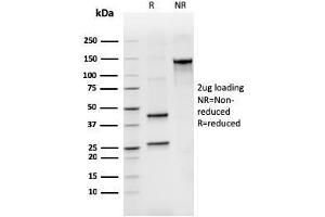 SDS-PAGE Analysis Purified BCL2L2 Mouse Monoclonal Antibody (CPTC-BCL2L2-2). (BCL2L2 抗体)