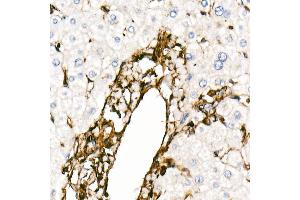 Immunohistochemistry (IHC) image for anti-Vimentin (VIM) antibody (ABIN7271326)
