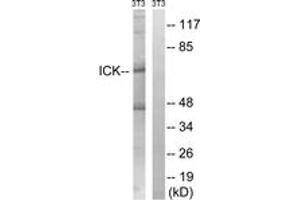 Western blot analysis of extracts from NIH-3T3 cells, treated with PBS 10uM 60', using ICK (Ab-159) Antibody.