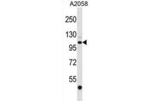 Western Blotting (WB) image for anti-ER Degradation Enhancer, Mannosidase alpha-Like 3 (EDEM3) antibody (ABIN2998830) (EDEM3 抗体)