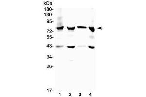 Western Blotting (WB) image for anti-Hydroxysteroid (17-Beta) Dehydrogenase 4 (HSD17B4) (C-Term) antibody (ABIN3031274)