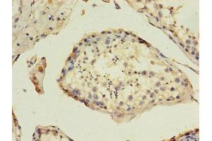 Immunohistochemistry of paraffin-embedded human testis tissue using ABIN7155031 at dilution of 1:100 (HAVCR1 抗体  (AA 21-290))