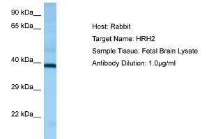Western Blotting (WB) image for anti-Histamine Receptor H2 (HRH2) (C-Term) antibody (ABIN2790187) (HRH2 抗体  (C-Term))