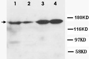 Western Blot analysis of ROCK2 expression from cell extracts with ROCK2 polyclonal antibody . (ROCK2 抗体  (N-Term))