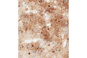 Immunohistochemical analysis of paraffin-embedded human brain tissue using B performed on the Leica® BOND RXm. (GFAP 抗体)