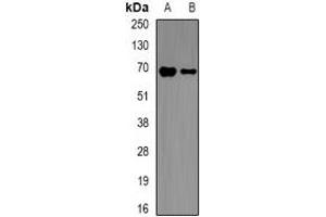 Western blot analysis of p67 phox expression in THP1 (A), mouse spleen (B) whole cell lysates.