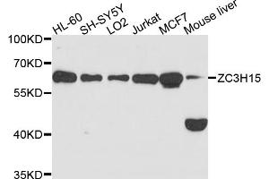 Western blot analysis of extracts of various cell lines, using ZC3H15 antibody (ABIN6003752) at 1/1000 dilution.