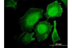 Immunofluorescence of monoclonal antibody to HCLS1 on HeLa cell. (HCLS1 抗体  (AA 266-355))