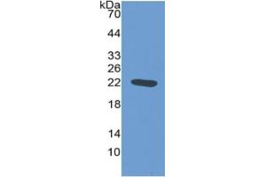 WB of Protein Standard: different control antibodies  against Highly purified E. (NOS2 ELISA 试剂盒)