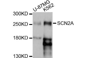 Western blot analysis of extracts of various cell lines, using SCN2A antibody (ABIN5998750) at 1/1000 dilution. (SCN2A 抗体)