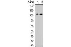 Western blot analysis of Thrombospondin 4 expression in A431 (A), HEK293T (B) whole cell lysates. (THBS4 抗体)