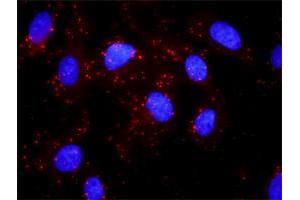 Proximity Ligation Analysis of protein-protein interactions between AKT1 and HSPB1. (HSP27 抗体  (AA 96-205))