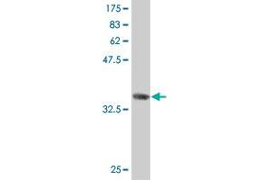 Western Blot detection against Immunogen (36. (AK8 抗体  (AA 381-479))