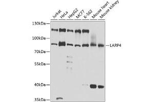 Western blot analysis of extracts of various cell lines, using L antibody (ABIN6132079, ABIN6143092, ABIN6143093 and ABIN6220849) at 1:1000 dilution. (LARP4 抗体  (AA 1-120))