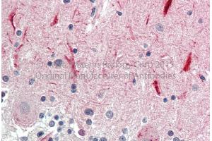 Rabbit Anti-GABRG2 Antibody Catalog Number: ARP36738_P050 Formalin Fixed Paraffin Embedded Tissue: Human Adult Brain, cerebellum  Observed Staining: Cytoplasm in hepatocytes Primary Antibody Concentration: 1:600 Secondary Antibody: Donkey anti-Rabbit-Cy3 Secondary Antibody Concentration: 1:200 Magnification: 20X Exposure Time: 0. (GABRG2 抗体  (N-Term))