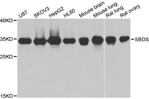 Western blot analysis of extracts of various cell lines, using SBDS antibody. (SBDS 抗体)