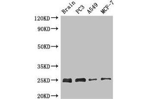 Western Blot Positive WB detected in: Mouse brain tissue, PC-3 whole cell lysate, A549 whole cell lysate, MCF-7 whole cell lysate All lanes: APOPT1 antibody at 2.