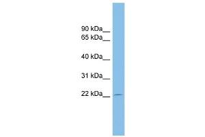 WB Suggested Anti-EBI3  Antibody Titration: 0. (EBI3 抗体  (Middle Region))