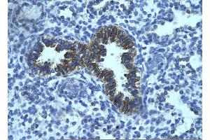 Rabbit Anti-PHF16 Antibody       Paraffin Embedded Tissue:  Human bronchiole epithelium   Cellular Data:  Epithelial cells of renal tubule  Antibody Concentration:   4. (PHF16 抗体  (Middle Region))
