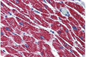 Human Heart: Formalin-Fixed, Paraffin-Embedded (FFPE) (HADH 抗体  (AA 205-315))