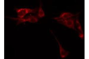 ABIN6267412 staining HeLa by IF/ICC. (SYN1 抗体  (pSer9))