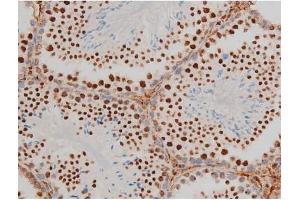 Immunohistochemistry (IHC) image for anti-GATA Binding Protein 1 (Globin Transcription Factor 1) (GATA1) (pSer142) antibody (ABIN6254982)
