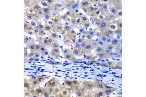 Immunohistochemistry of paraffin-embedded human liver injury using PSMD8 antibody.