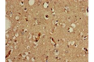 Immunohistochemistry of paraffin-embedded human brain tissue using ABIN7164093 at dilution of 1:100 (PRDM2 抗体  (AA 733-961))