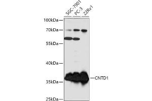 Western blot analysis of extracts of various cell lines, using CNTD1 antibody (ABIN7266574) at 1:1000 dilution. (CNTD1 抗体  (AA 1-120))