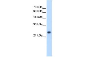 WB Suggested Anti-NNMT Antibody Titration:  2. (NNMT 抗体  (N-Term))