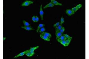 Immunofluorescent analysis of HepG2 cells using ABIN7165984 at dilution of 1:100 and Alexa Fluor 488-congugated AffiniPure Goat Anti-Rabbit IgG(H+L) (PIH1D3 抗体  (AA 1-214))