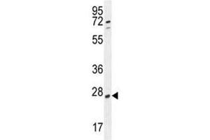 RPEL1 antibody western blot analysis in K562 lysate (Ribulose-5-Phosphate-3-Epimerase-Like (RPEL1) (AA 187-215) 抗体)