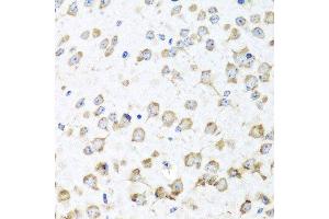 Immunohistochemistry (Paraffin-embedded Sections) (IHC (p)) image for anti-Ribosomal Protein L36 (RPL36) (AA 1-105) antibody (ABIN6147141)
