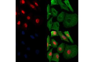 Phospho-SAMHD1 (Thr592) Antibody staining A549 cells(H2O2 treatment) by IF/ICC. (SAMHD1 抗体  (pThr592))