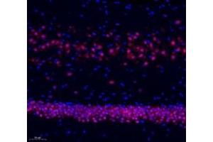 Immunofluorescence of paraffin embedded rat hippocampus using neun (ABIN7075479) at dilution of 1: 500 (200x lens) (NeuN 抗体)