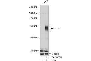 Western blot analysis of extracts of HeLa cells, using c-Fos antibody (ABIN3020747, ABIN3020748, ABIN3020749, ABIN1512925 and ABIN6213704) at 1:1000 dilution. (c-FOS 抗体  (AA 211-380))