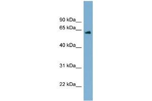 WB Suggested Anti-C12orf4 Antibody Titration: 0. (C12orf4 抗体  (Middle Region))