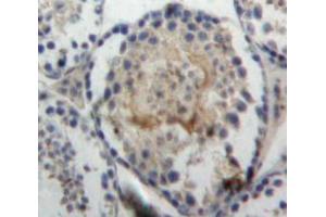 Immunohistochemistry (IHC) image for anti-Von Willebrand Factor A Domain Containing 1 (VWA1) (AA 135-366) antibody (ABIN1863302)