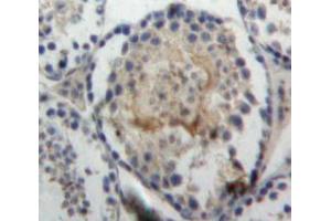 Used in DAB staining on fromalin fixed paraffin-embedded Testis tissue (VWA1 抗体  (AA 135-366))