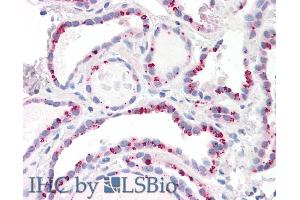ABIN184646 (10µg/ml) staining of paraffin embedded Human Thyroid.