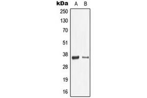 Western blot analysis of Galectin 9 expression in THP1 (A), mouse spleen (B) whole cell lysates.