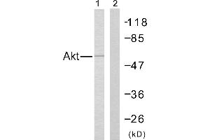 Western blot analysis of the extracts from Jurkat cells using Akt (Ab-308) antibody (#B7005). (AKT1 抗体  (Thr308))