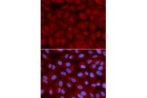 Immunofluorescence (IF) image for anti-Bridging Integrator 1 (BIN1) antibody (ABIN1871291) (BIN1 抗体)