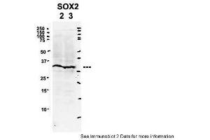 Sample Type: 2. (SOX2 抗体  (Middle Region))