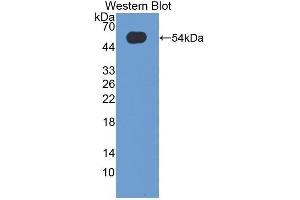 Detection of Recombinant OSM, Human using Polyclonal Antibody to Oncostatin M (OSM) (Oncostatin M 抗体  (AA 26-220))