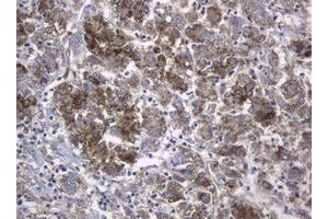 Image no. 2 for anti-Mast/stem Cell Growth Factor Receptor (KIT) (AA 546-976) antibody (ABIN1491585) (KIT 抗体  (AA 546-976))