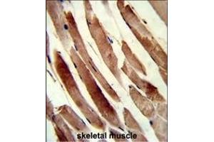 Immunohistochemistry (Paraffin-embedded Sections) (IHC (p)) image for anti-Transgelin (TAGLN) (AA 24-51), (N-Term) antibody (ABIN390626)