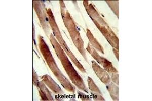 Formalin-fixed and paraffin-embedded human skeletal muscle reacted with TAGLN Antibody (N-term), which was peroxidase-conjugated to the secondary antibody, followed by DAB staining. (Transgelin 抗体  (N-Term))